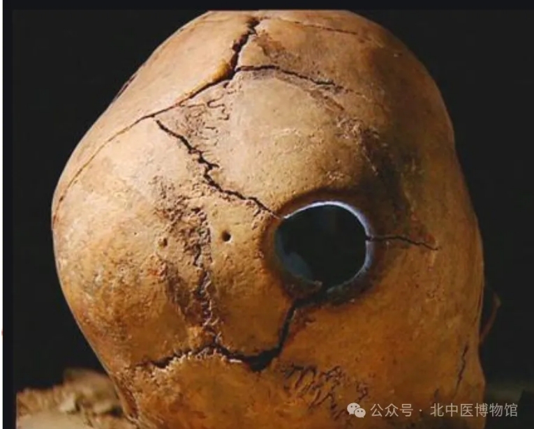 牙齿2.png